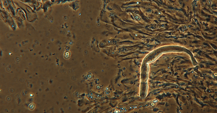 Crosta di faggio - foto1488 (Gloeocystidiellum leucoxanthum)